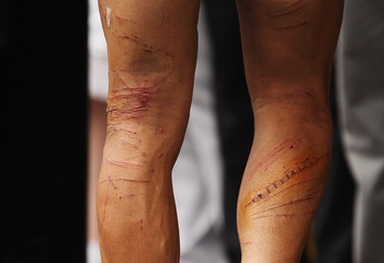 Зачем велогонщики бреют ноги? 